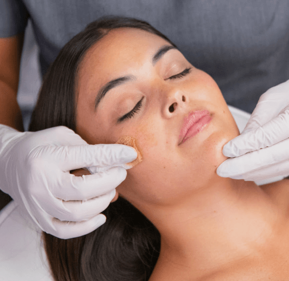 Introducing the VI Peel: Transform Your Skin at NG Skin Clinic - ngskinclinic