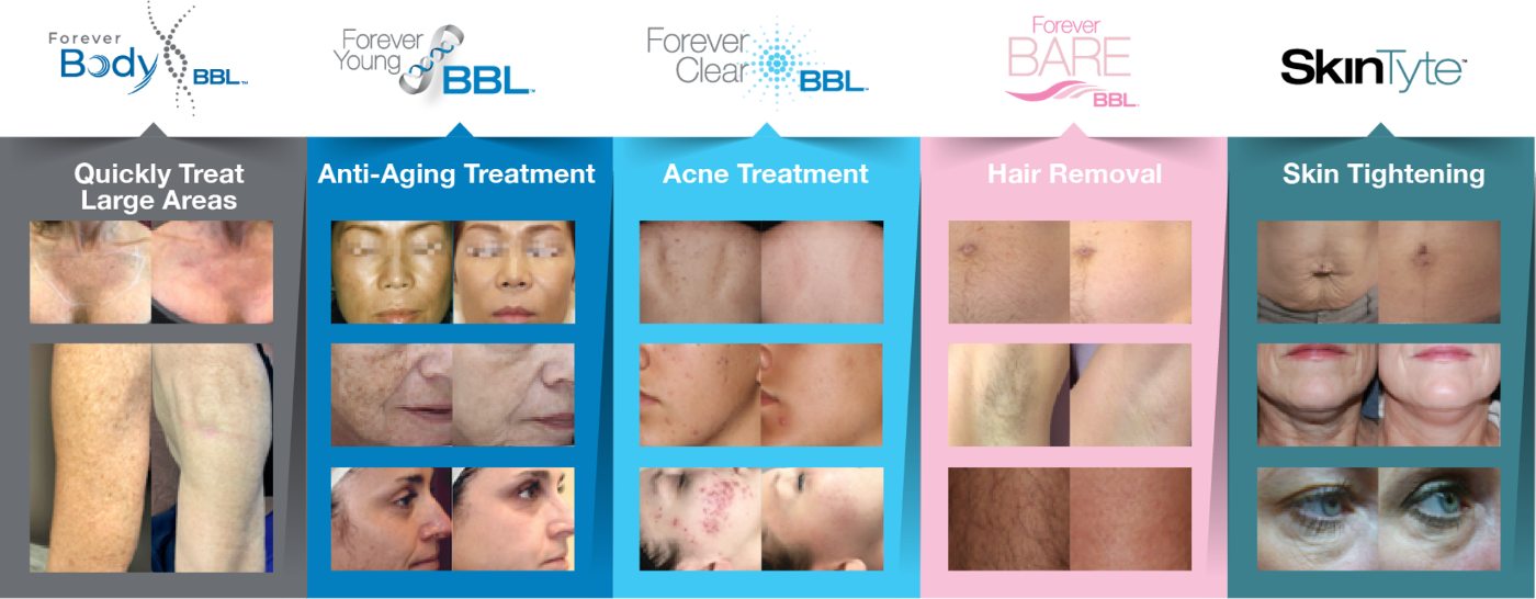 forever bbl hero market harborough