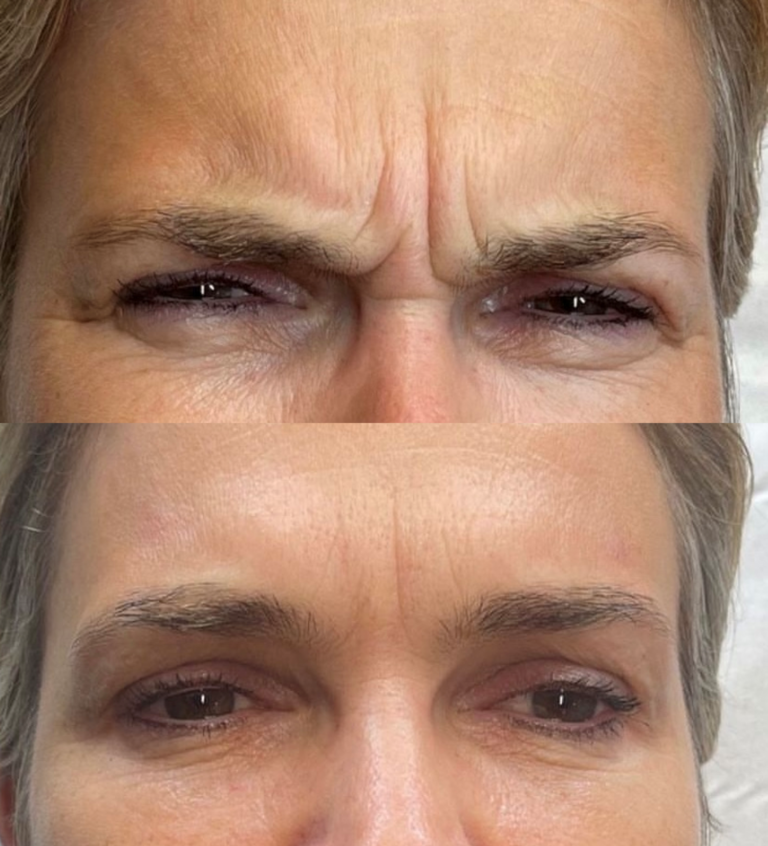 ng skin clinic anti-wrinkle treatment