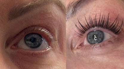 Christmas Offer: LiLash Purified Eyelash Serum - Buy One Get One Half Price! - NG Skin Clinic