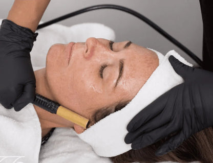 Collagenwave x 6 for 5 - NG Skin Clinic