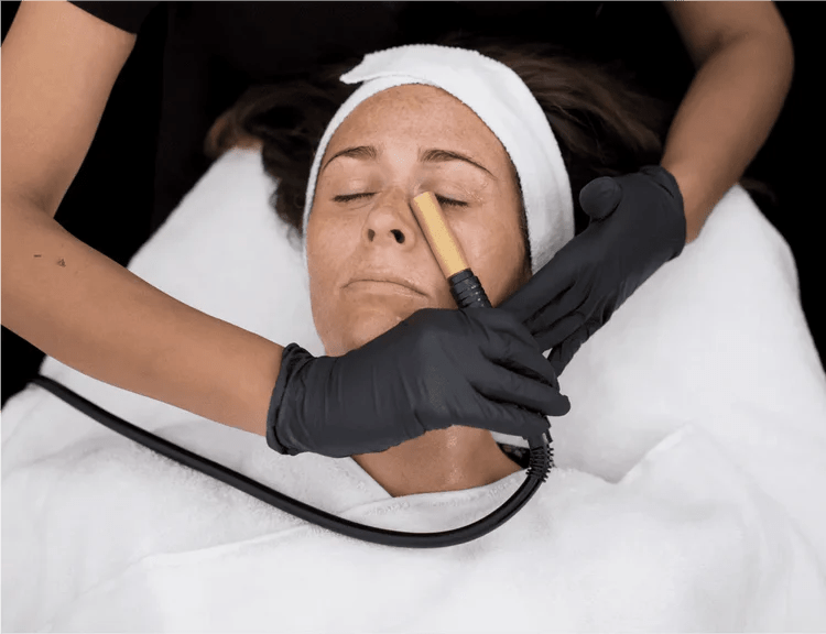 Collagenwave x 6 for 5 - NG Skin Clinic