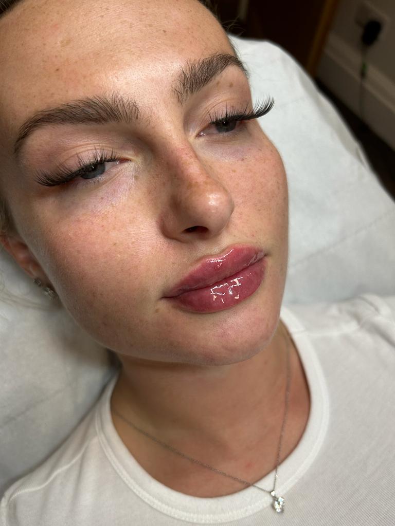 ng skin clinic dermal fillers