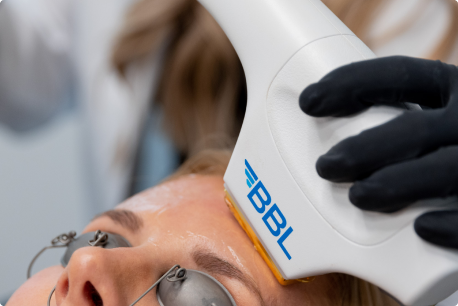 ng skin clinic market harborough bbl2