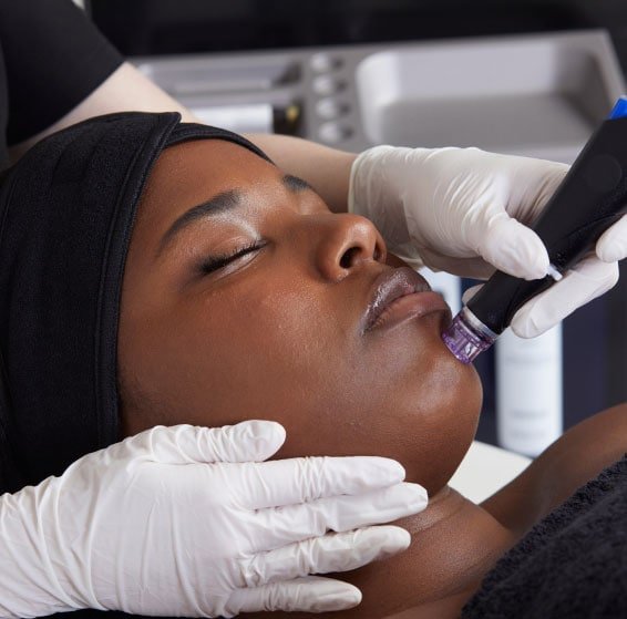 Platinum Hydrafacial - Buy 5 Get One Free - NG Skin Clinic